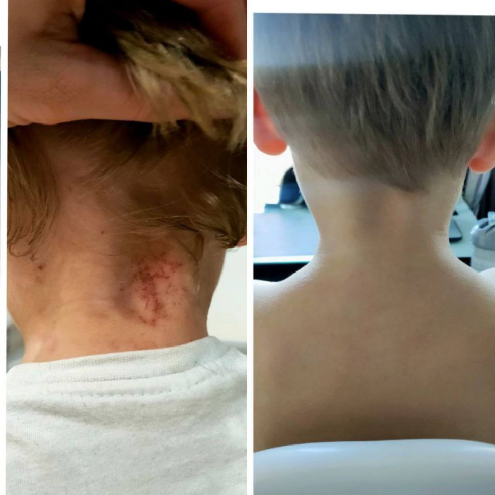 Антипаразитарный порошок детский 100г (дой-пак)